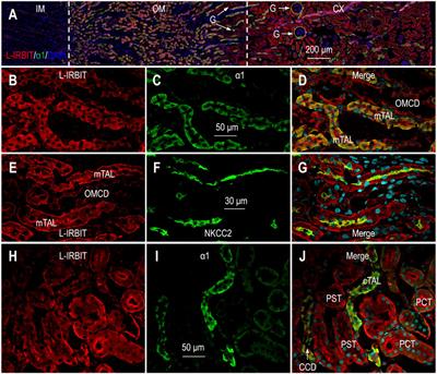 Dietary sodium enhances the expression of SLC4 family transporters, IRBIT, L-IRBIT, and PP1 in rat kidney: Insights into the molecular mechanism for renal sodium handling